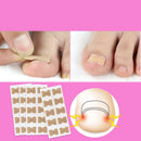 Adesivo para unha encravada - 100 unidades