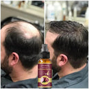 Spray antiqueda ,reparação de folículos capilares para  homens e mulheres.