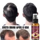 Spray antiqueda ,reparação de folículos capilares para  homens e mulheres.