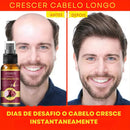 Spray antiqueda ,reparação de folículos capilares para  homens e mulheres.